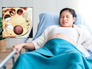 Bà bầu - Nhiều mẹ bầu chọn giờ sinh mổ: Đừng quên những lợi ích của sinh thường