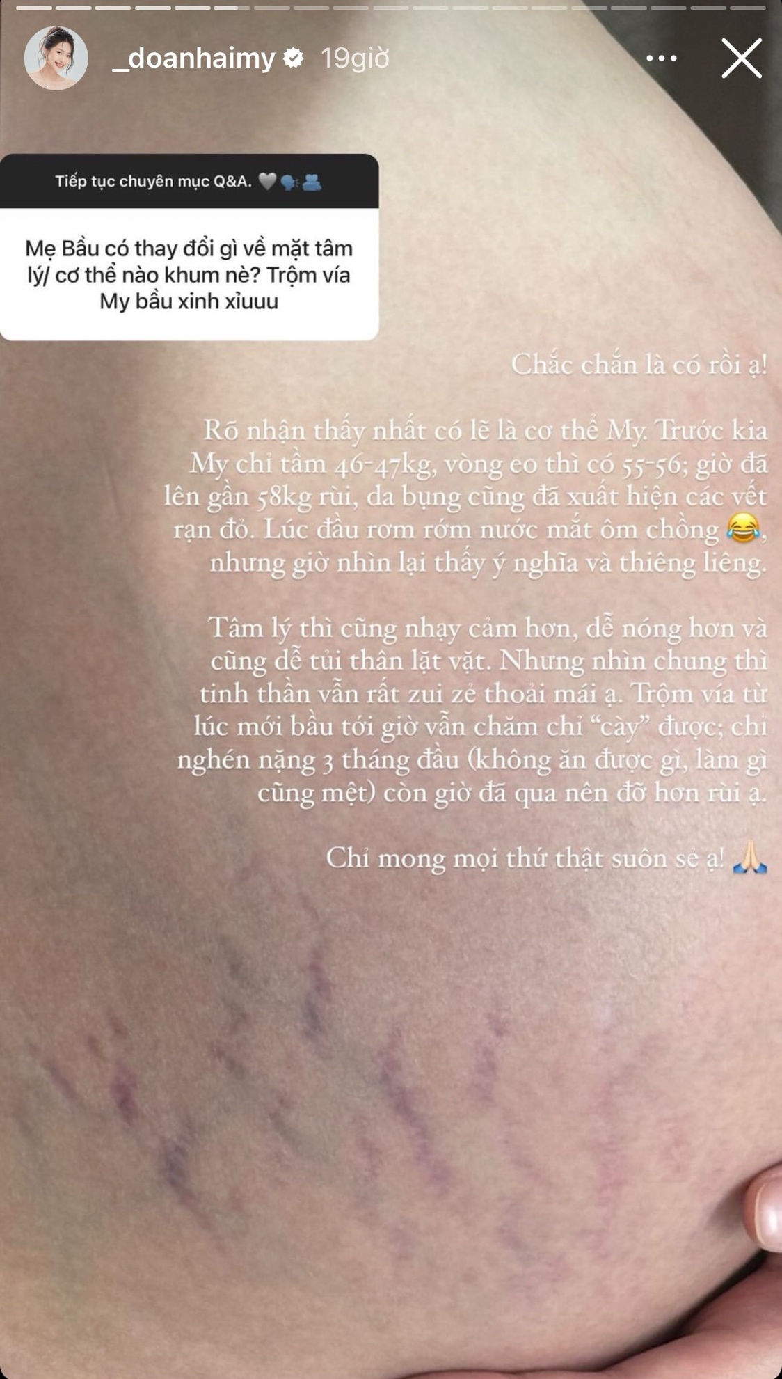 Doãn Hải My không tránh được “kiếp nạn” này khi mang thai, rơm rớm nước mắt ôm chồng - 1