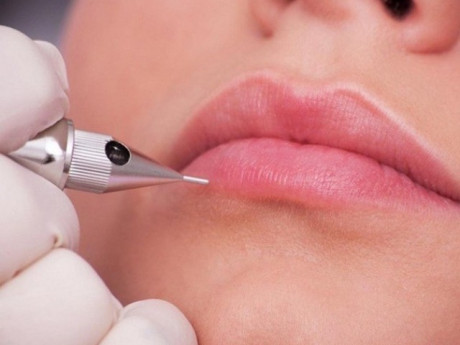 Sau 3 ngày xăm môi, cô gái có dấu hiệu lạ nghi sùi mào gà, hóa ra mắc loại bệnh không thể chữa khỏi