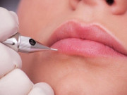 Sức khỏe - Sau 3 ngày xăm môi, cô gái có dấu hiệu lạ nghi sùi mào gà, hóa ra mắc loại bệnh không thể chữa khỏi