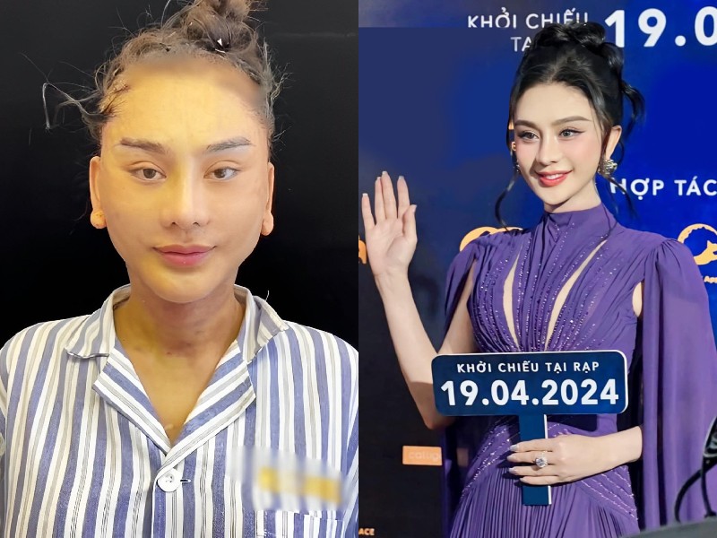 So với hình ảnh lúc mới phẫu thuật, Lâm Khánh Chi giờ đây ngày càng nữ tính, xinh đẹp hệt như "con gái thật". Làn da của cô giờ đây căng mịn, không còn nhiều nếp nhăn.
