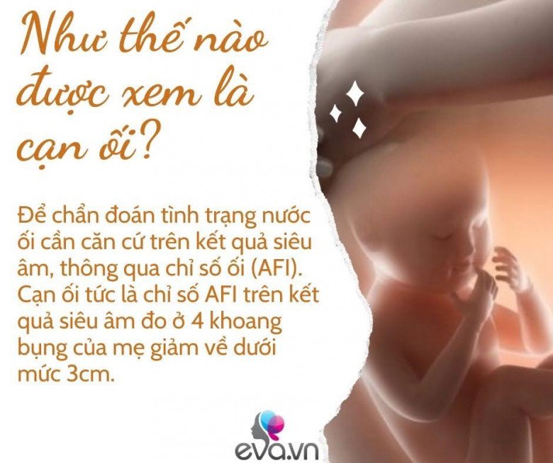 Bị cạn ối khi nào thì nguy hiểm cho thai nhi? - 5