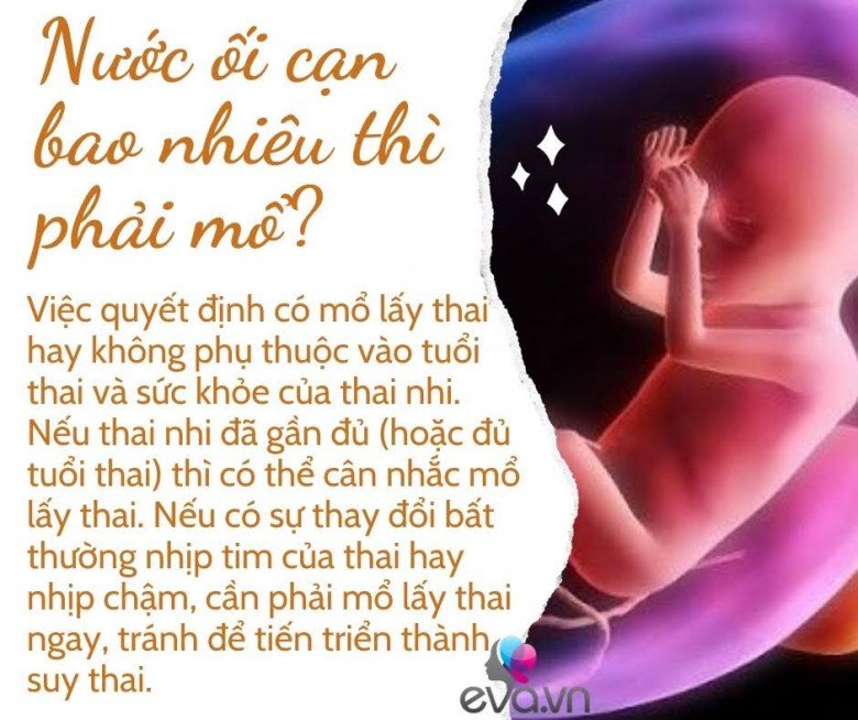 Bị cạn ối khi nào thì nguy hiểm cho thai nhi? - 7