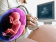 Bà bầu - Bị cạn ối khi nào thì nguy hiểm cho thai nhi?