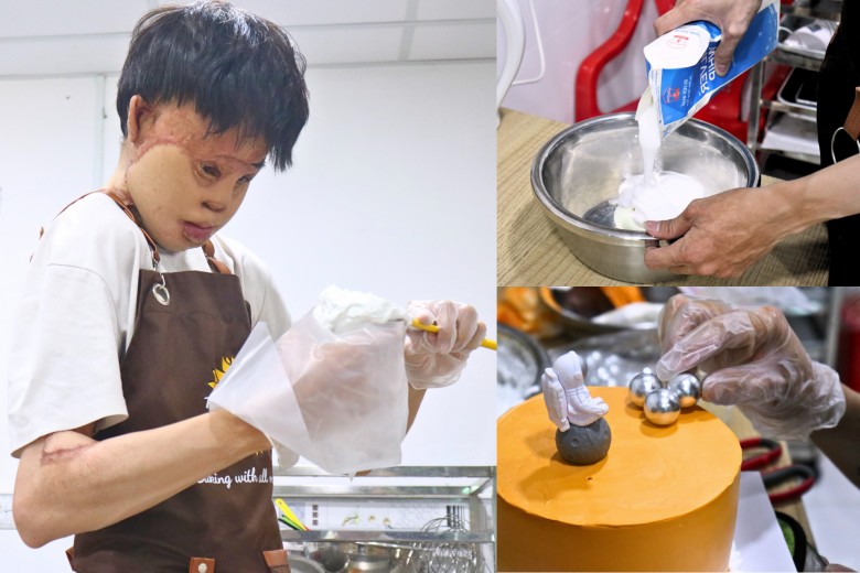 30 năm với 20 cuộc phẫu thuật từ khuôn mặt biến dạng, Hải amp;#34;sẹoamp;#34; hy vọng: Không ai gọi mình là amp;#34;dị nhânamp;#34; - 1