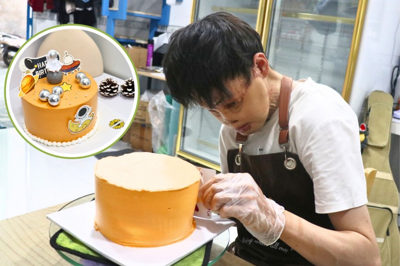 30 năm với 20 cuộc phẫu thuật từ khuôn mặt biến dạng, Hải amp;#34;sẹoamp;#34; hy vọng: Không ai gọi mình là amp;#34;dị nhânamp;#34; - 5