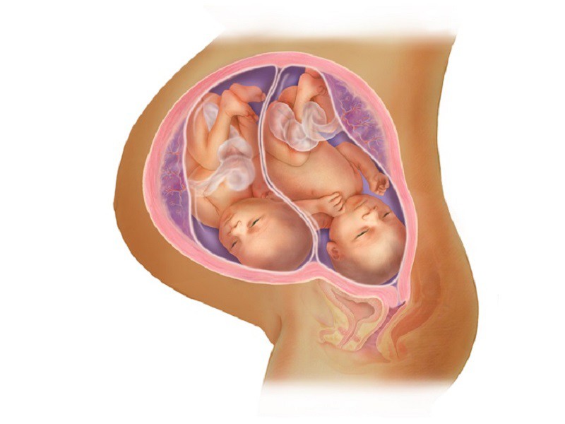 36 tuần: Tuổi thai trung bình của cặp song sinh khi sinh là 36 tuần. Các bé dành vài tuần cuối cùng để xây dựng các lớp mỡ, tăng cân và rụng gần hết lông trên cơ thể. 
