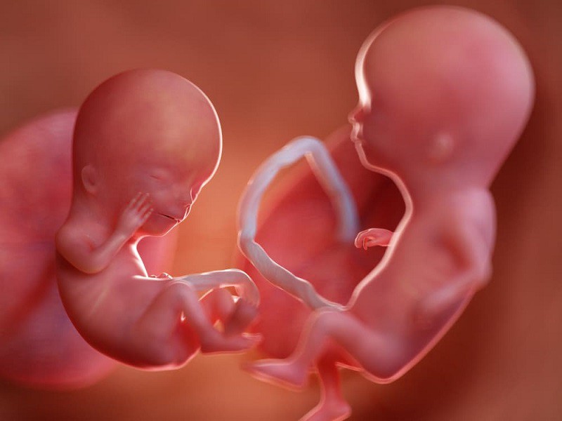 Sự phát triển của các thai song sinh trong bụng mẹ cũng khiến nhiều người tò mò.
