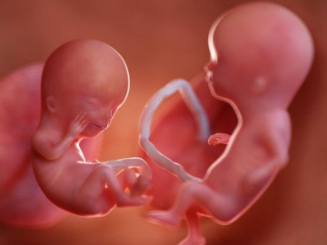 Vào bụng mẹ xem tận mắt quá trình phát triển hết sức thú vị của các cặp song sinh