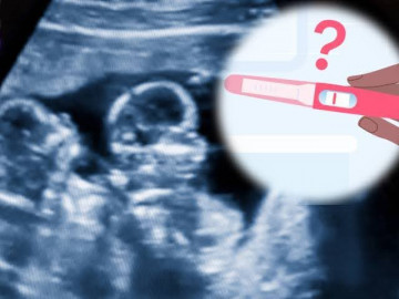 Mang thai đôi, đa thai nhưng que thử thai lại cho kết quả âm tính là như thế nào?