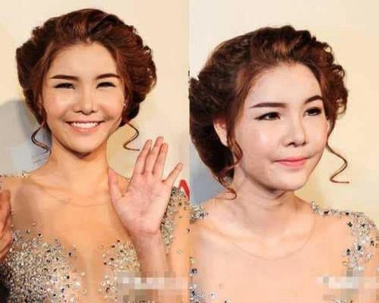 Bà xã Mạc Hồng Quân từng bị khủng hoảng vì phẫu thuật hỏng.