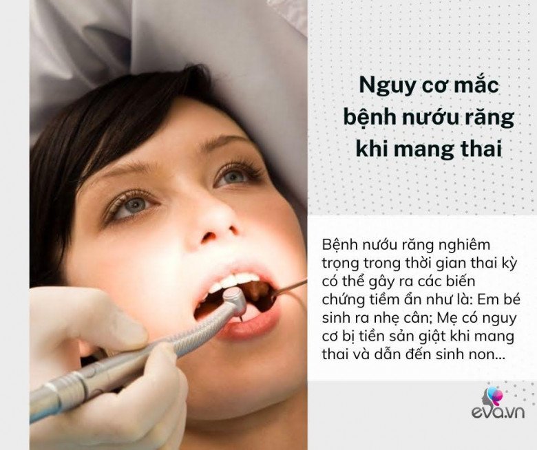 Đi khám nha khoa trong thời gian mang bầu có an toàn không? - 3