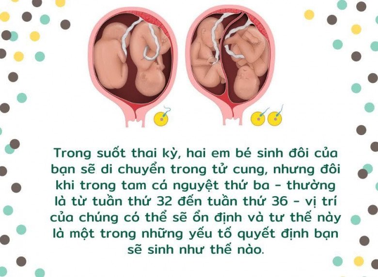 Khám phá các vị trí của cặp song sinh trong bụng mẹ và ảnh hưởng của nó đến quá trình sinh nở - 1