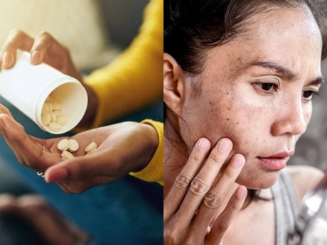 Tại sao chuyên gia khuyên không nên uống vitamin C để làm trắng da? Chị em nghe xong sẽ phải suy nghĩ lại