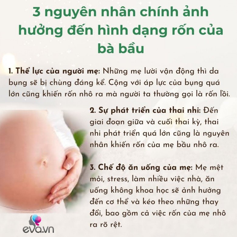 Tại sao rốn của mẹ lại thay đổi chỉ sau một đêm khi mang thai? - 3
