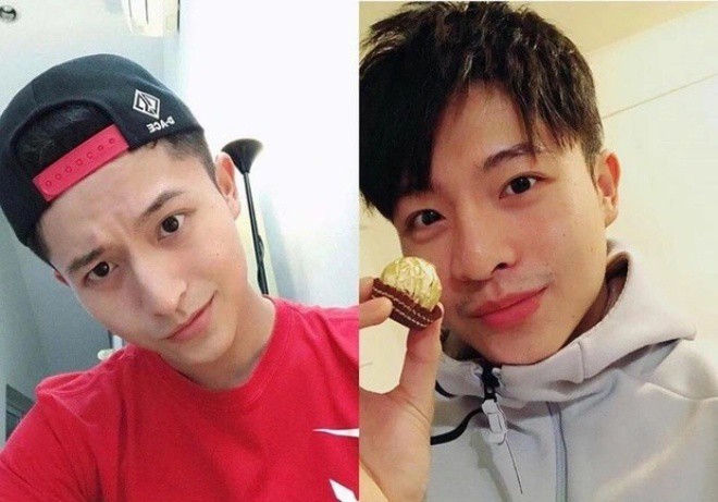 Nhan sắc trước (trái) và sau tai nạn (phải) của Harry Lu từng là chủ đề bàn tán xôn xao.