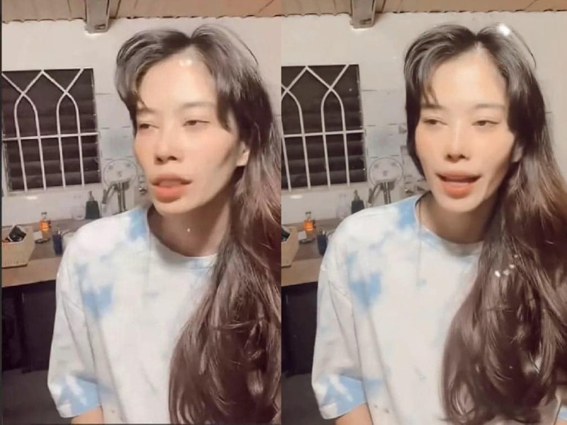 Mới đây, ngoại hình khác lạ của Nam Em trong buổi livestream đã 'gây bão' mạng xã hội. Qua một số hình ảnh được chia sẻ, người đẹp xuất hiện với đầu bù tóc rối, gương mặt hốc hác thấy rõ gò phần má hóp, đầu để lộ hói khiến người xem 'giật mình'.
