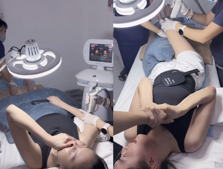 Quá trình trị sẹo đầy đau đớn của Ngọc Trinh.