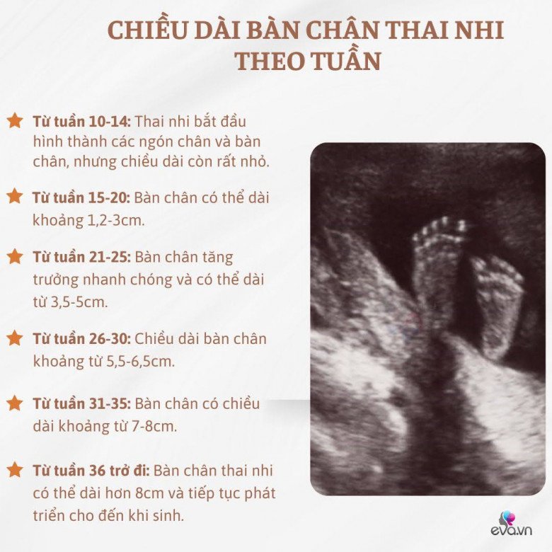 Chiều dài bàn chân thai nhi tiết lộ điều gì với mẹ? - 2