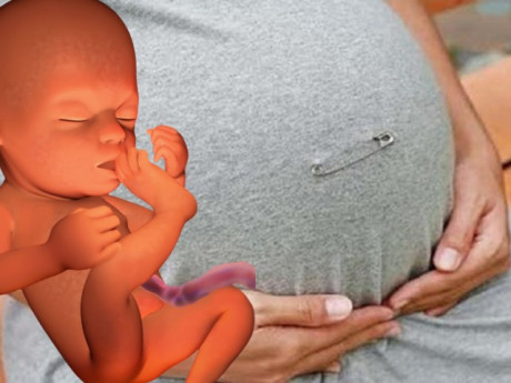 Tại sao mẹ bầu Thái Lan thường cài kim băng trước bụng khi mang thai 3 tháng đầu?