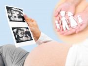 Bà bầu - Sinh đôi trong trường hợp nào thì có liên quan đến di truyền?