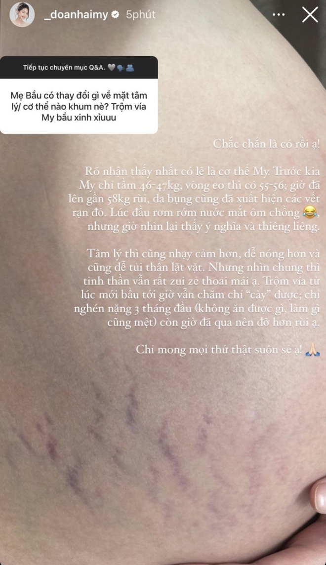 Mẹ bầu cũng bị rạn đỏ.