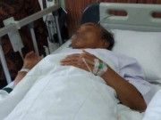 Sức khỏe - Người đàn ông 60 tuổi bị hoại tử ruột non vì thường xuyên ăn loại quả mà người Việt yêu thích