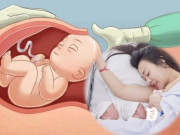 Bà bầu - Phương Oanh sinh mổ đón 2 bé rồng: Tại sao thai đôi nên sinh mổ và khi nào có thể sinh thường?