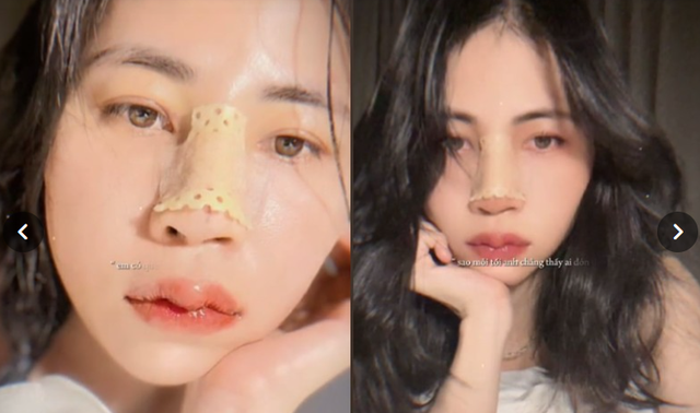 Dân tình đặt câu hỏi nhạy cảm về việc Thơ Nguyễn amp;#34;dao kéoamp;#34;, nữ YouTuber nói gì? - 2