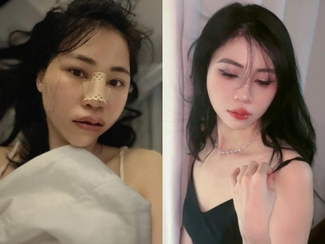 Dân tình đặt câu hỏi nhạy cảm về việc Thơ Nguyễn "dao kéo", nữ YouTuber nói gì?