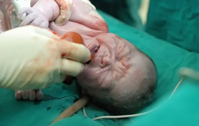 Em bé chào đời trong niềm hạnh phúc của người mẹ.