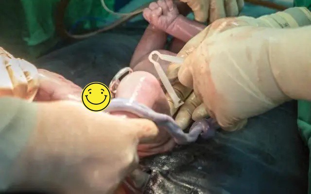 Sản phụ sinh mổ không cần thuốc gây tê, y bác sĩ vừa phẫu thuật vừa rơi lệ vì thương - 2