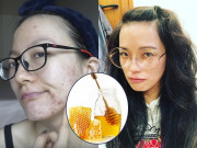 Làm đẹp - Sự khác biệt giữa uống mật ong và đắp lên mặt, cách nào giúp da dẻ láng mịn, trắng sáng không tì vết?