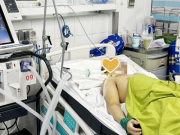 Sức khỏe - Thanh niên 21 tuổi ở Phú Thọ nguy kịch do sốc nhiệt nặng sau 2 giờ đi xe máy giữa trời nắng