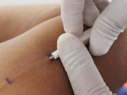 Bà bầu - Những trường hợp chống chỉ định với cấy que tránh thai