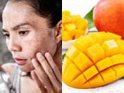 Đẹp - 10 thực phẩm khiến da dễ bắt nắng, chị em muốn ăn phải lựa đúng thời điểm nếu không da ngày càng sạm đen