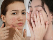 Làm đẹp - 4 sai lầm kinh điển khi dưỡng trắng da, chị em dùng mỹ phẩm đắt tiền chỉ gây uổng phí