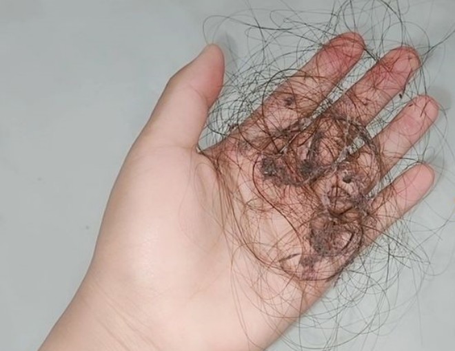 Tóc rụng khắp nơi trong nhà, ᵭȃy là 10 mẹo dọn tóc rụng vừa dễ dàng vừa hiệu quả - 1