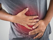 Sức khỏe - Gia đình 3 người cùng mắc ung thư đại tràng, cảnh báo thói quen nhiều người Việt hay mắc phải