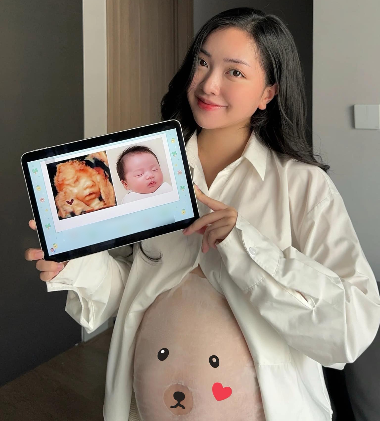 Mai Hà Trang khoe hình ảnh siêu âm 4D của em bé trong bụng.