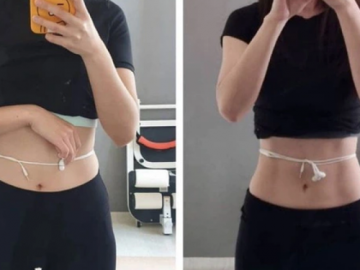 Bác sĩ Nhật giảm 14 kg nhờ thay cơm bằng loại rau rẻ tiền