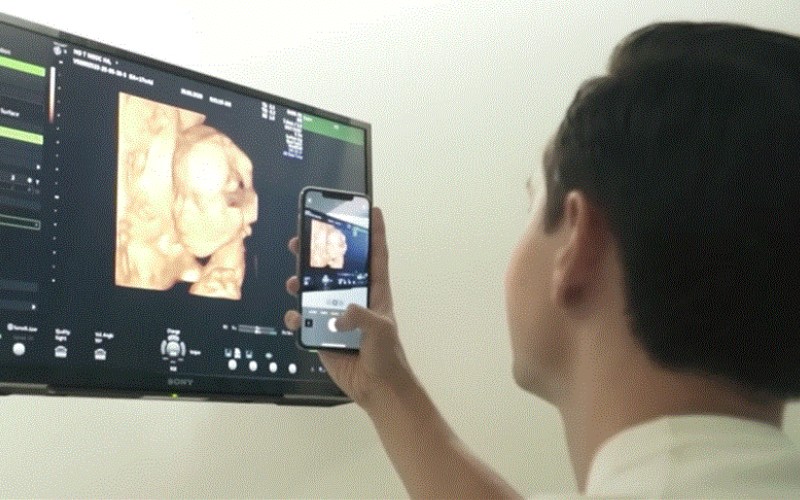 Khoảnh khắc Kim Lý đứng chụp ảnh em bé qua màn hình siêu âm làm tan chảy trái tim của nhiều fans hâm mộ.
