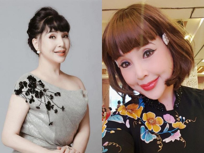NSND Lan Hương thừa nhận can thiệp thẩm mỹ 2 má.