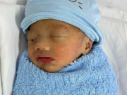 Bà bầu - Trẻ đẻ rơi tại nhà non tháng bị suy hô hấp, bác sĩ sản khoa đưa ra khuyến cáo