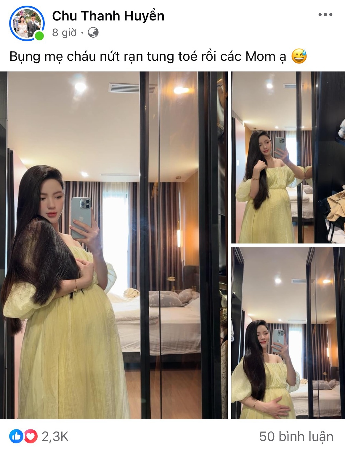 Chu Thanh Huyền bị rạn da nhiều khi mang thai.