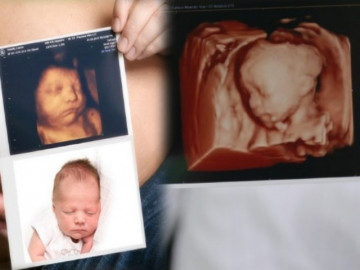 Mọi điều bà bầu cần biết về siêu âm 3D và 4D