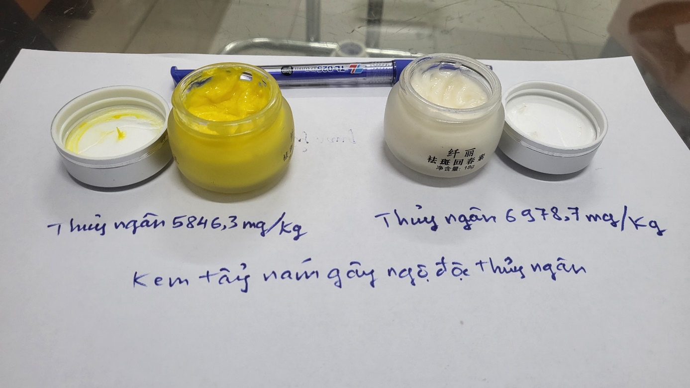 Bộ kem tẩy nám chứa thủy ngân mà 4 bệnh nhân cùng sử dụng. Ảnh: Quỳnh Mai.