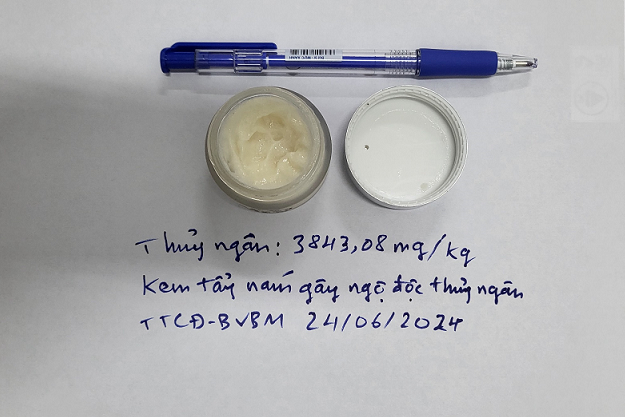 Loại kem tẩy nám chứa thủy ngân có giá 50.000 đồng khiến nữ bệnh nhân ở Sơn La bị ngộ độc nặng. Ảnh: Quỳnh Mai.