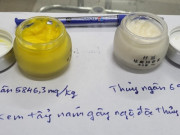 Sức khỏe - Hôn mê, tổn thương não, suy thận sau 1 năm dưỡng da bằng kem tẩy nám chứa thủy ngân