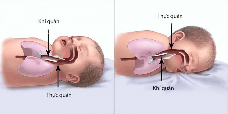 Bé gái 2 tuổi ra đi mãi mãi lúc đang nằm ngủ, người mẹ gục ngã khi biết lỗi do mình - 3